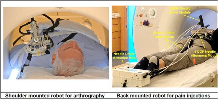 Pediatric Surgical Innovation at Children’s National Medical Center: Device Development and Rehabilitation for the Pediatric Environment MRI-Guided Robotics for Interventions in the Bore of the Magnet