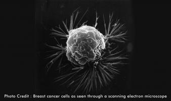 Curing Cancer – An effective treatment on the horizon