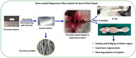IIT Madras Researchers develop Nano-Coated Magnesium Alloys to Repair Bone Fractures