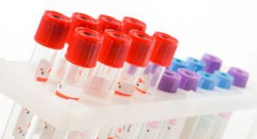 National Cancer Tissue Biobank (NCTB)