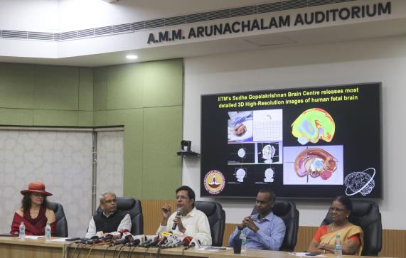 IIT Madras releases most detailed 3D High-Resolution images of Human Fetal Brain